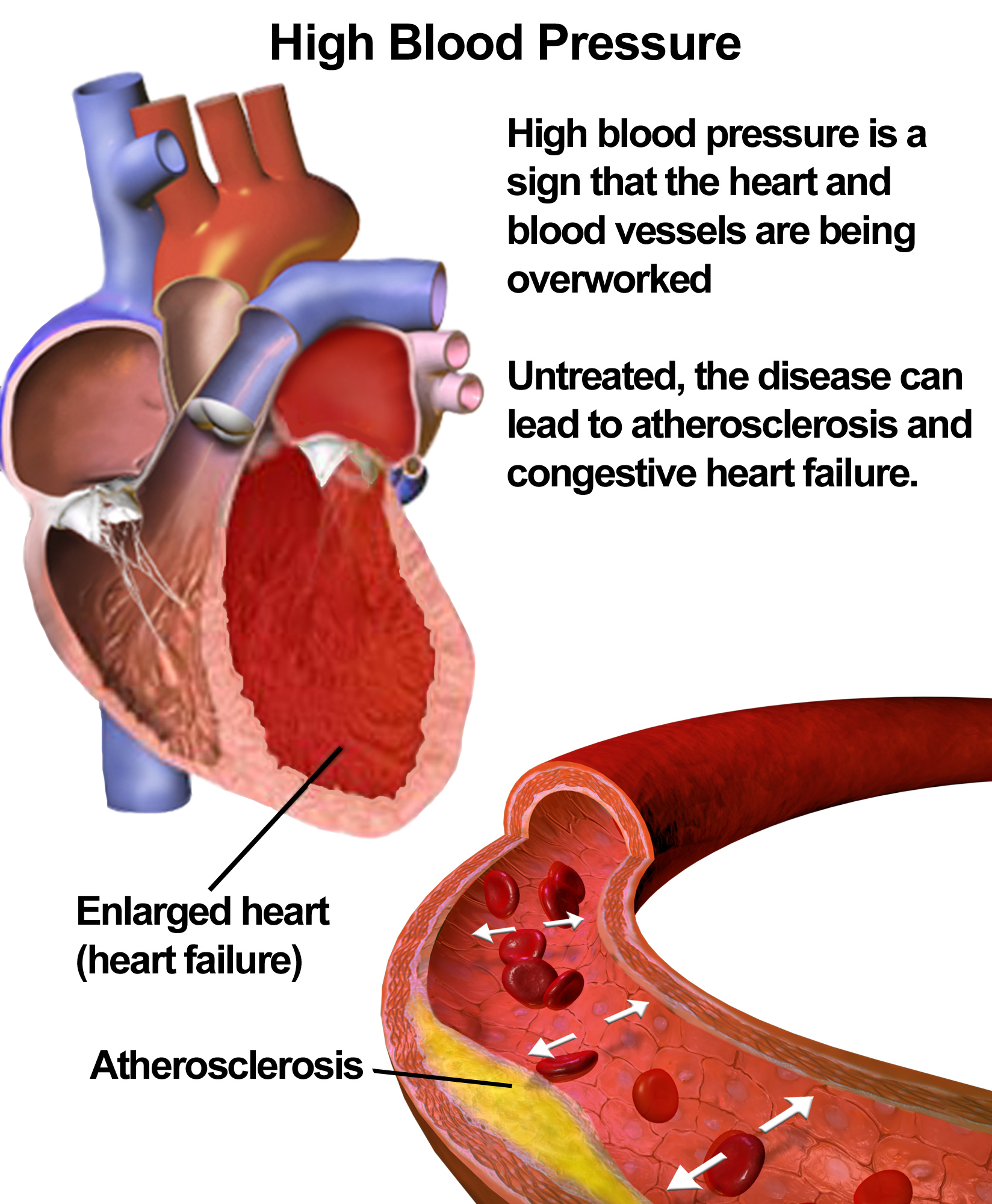 5 Ways Alcohol Affects Your Heart