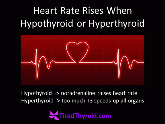 A Fast Heart Rate Occurs When Hypothyroid or Hyperthyroid ...