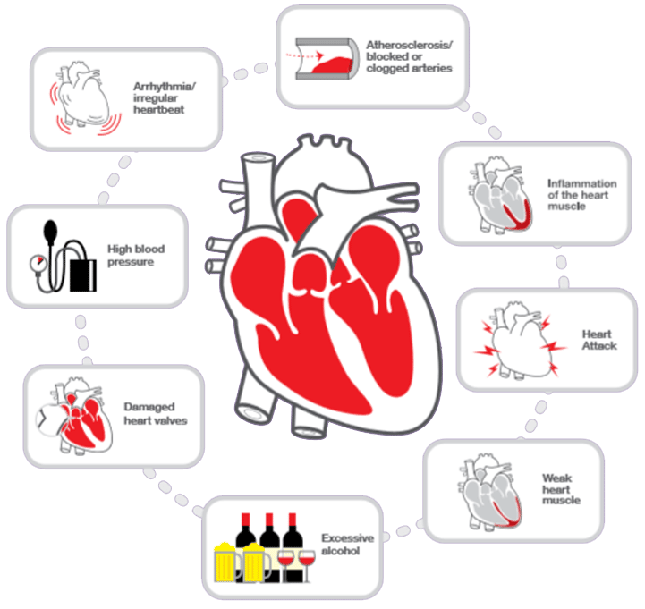 Can Alcohol Cause Heart Disease