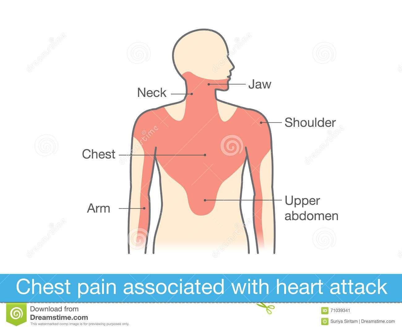 Chest Pain Associated With Heart Attack Stock Vector ...