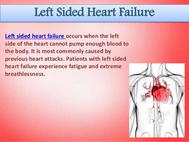 Common Causes of Heart Failure
