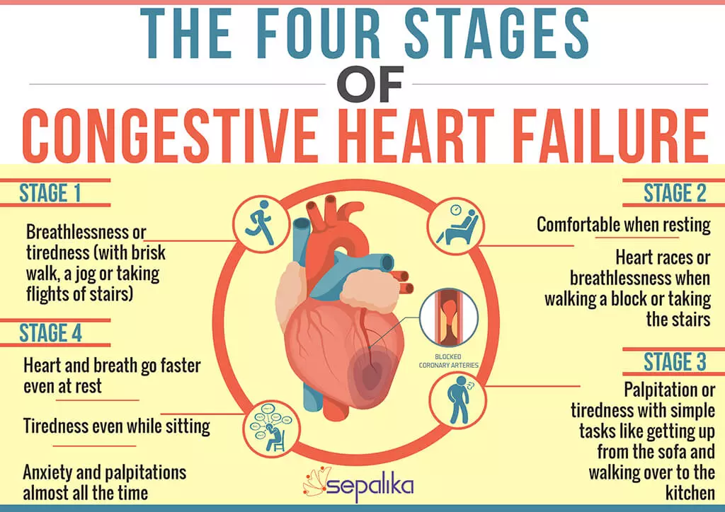 Congestive Heart Failure (CHF): Symptoms, Stages, Life Expectancy ...