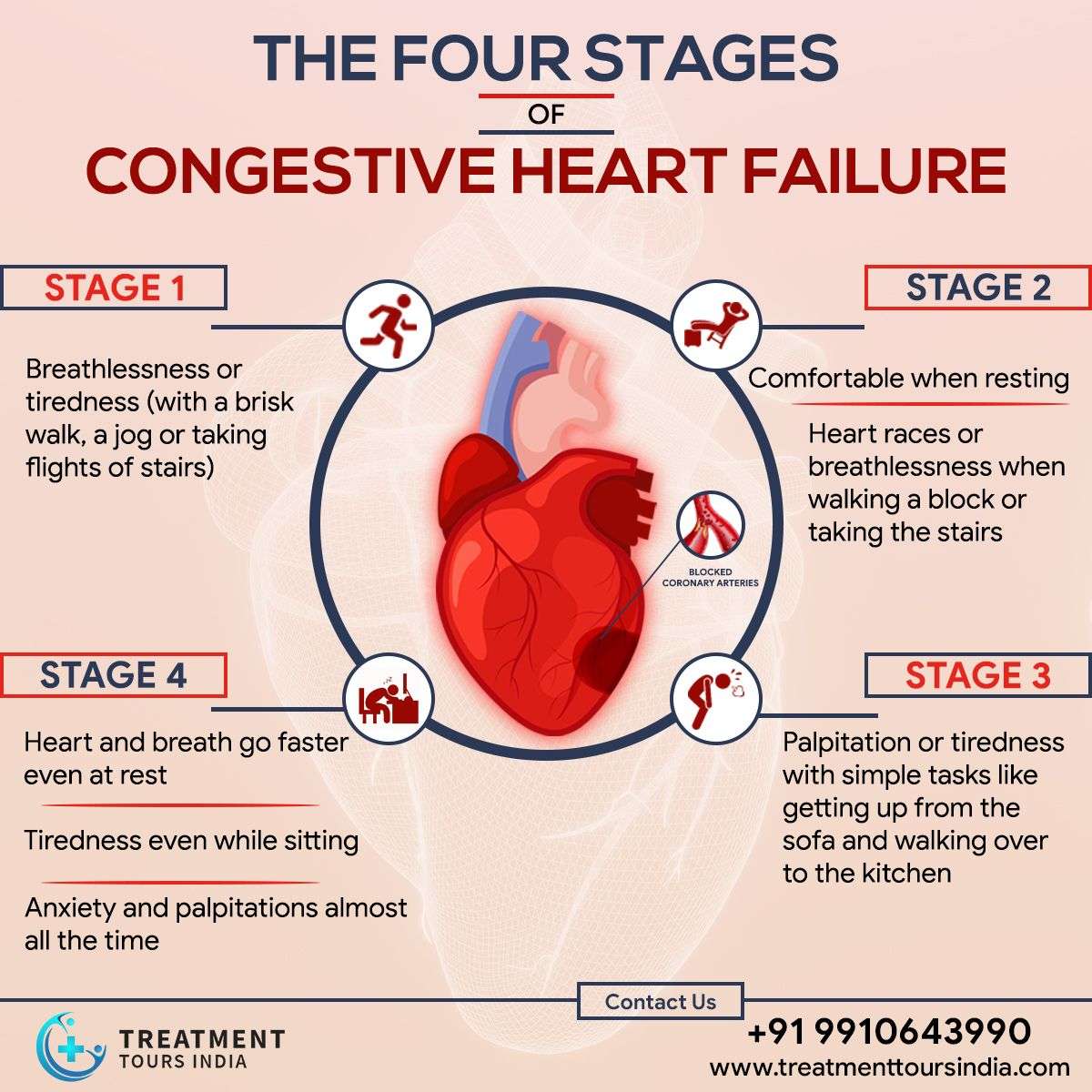 Congestive Heart Failure doesnt happen in a day  it takes ...