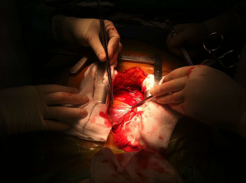 Difference Between Triple Bypass and Open Heart Surgery