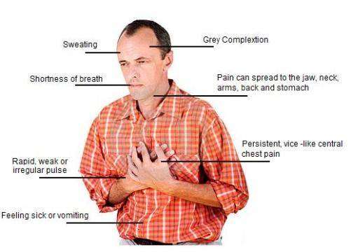 Does having angina mean that you have the same symptoms ...