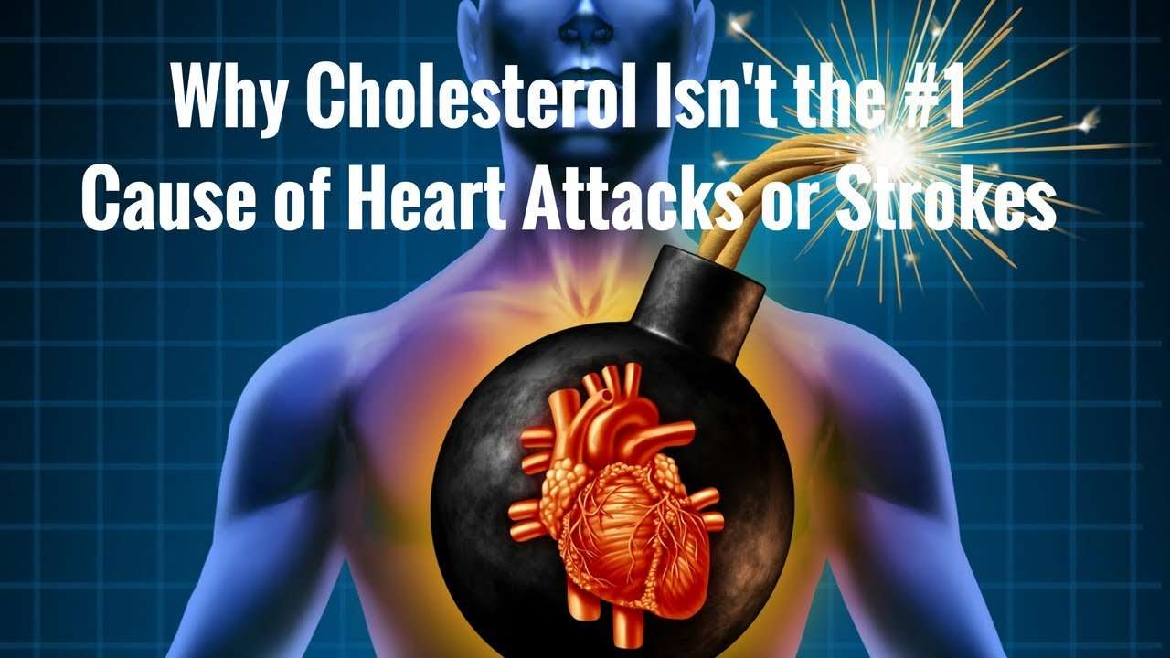 Does High Cholesterol Cause Heart Attacks?