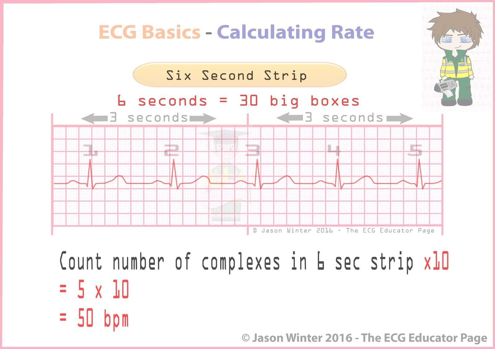 ECG Educator Blog : Basic Electrophysiology