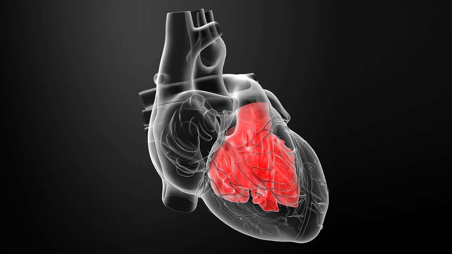 Enlarged Heart (Cardiomegaly) and Heart Failure