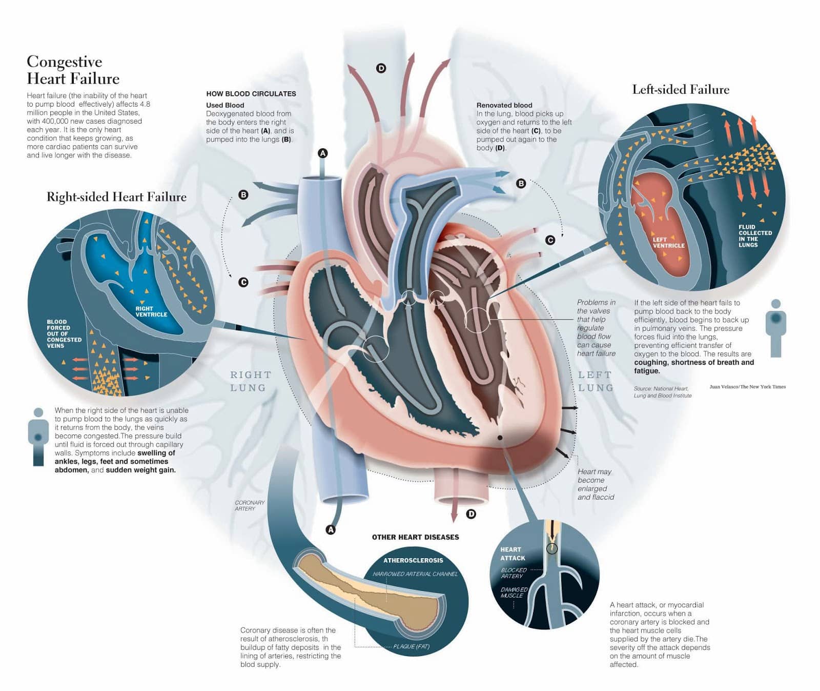 Estudos em Enfermagem: Infographics