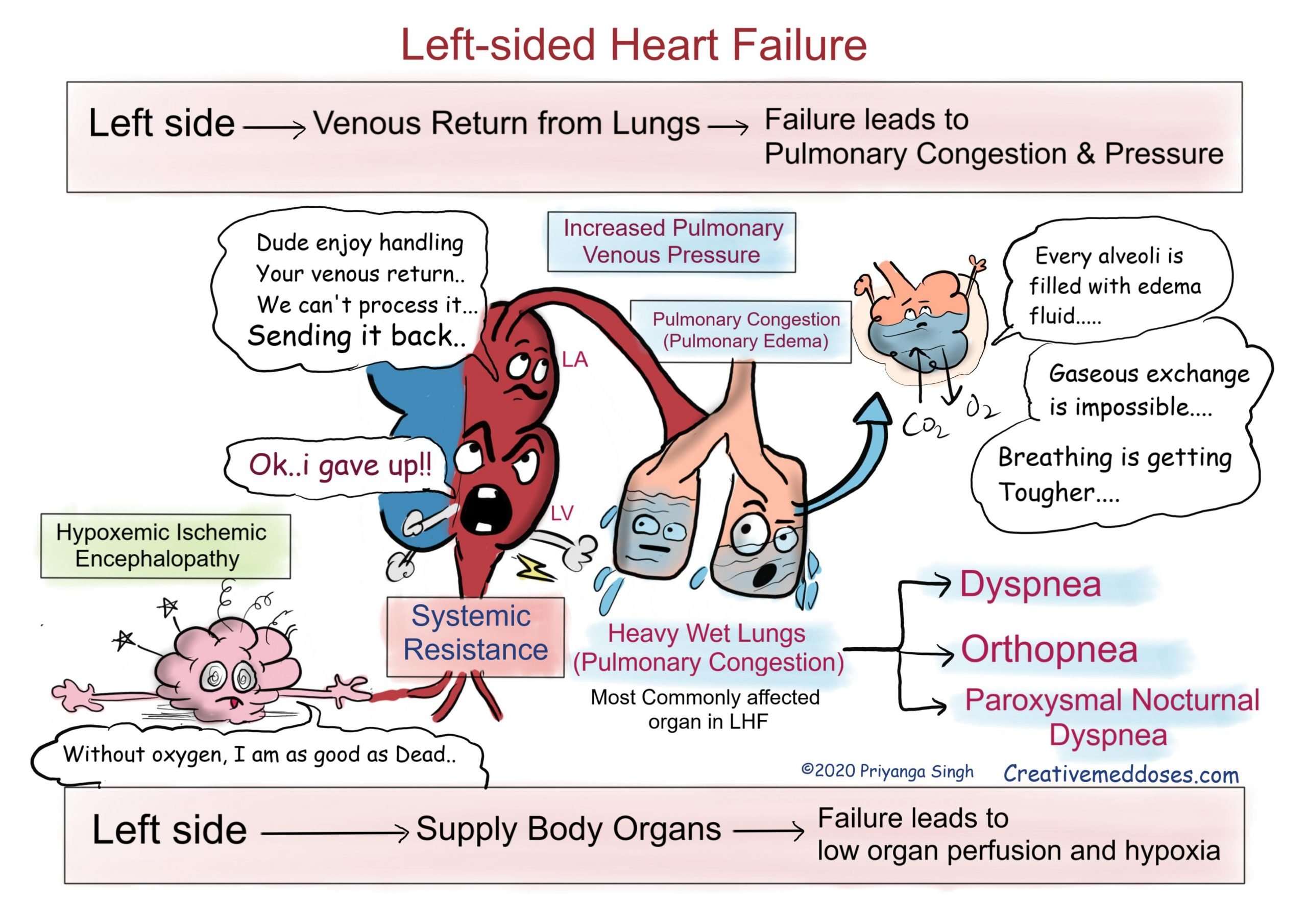 Heart Failure: Left sided VS Right sided