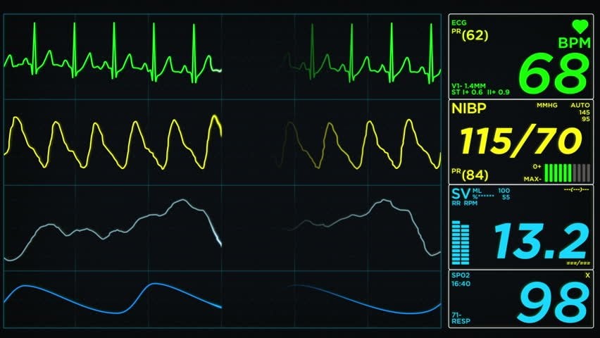 Heart Rate Monitor Stock Footage Video
