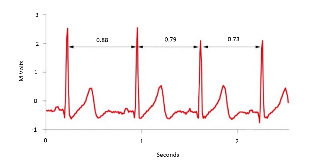Heart Rate Variability (HRV)