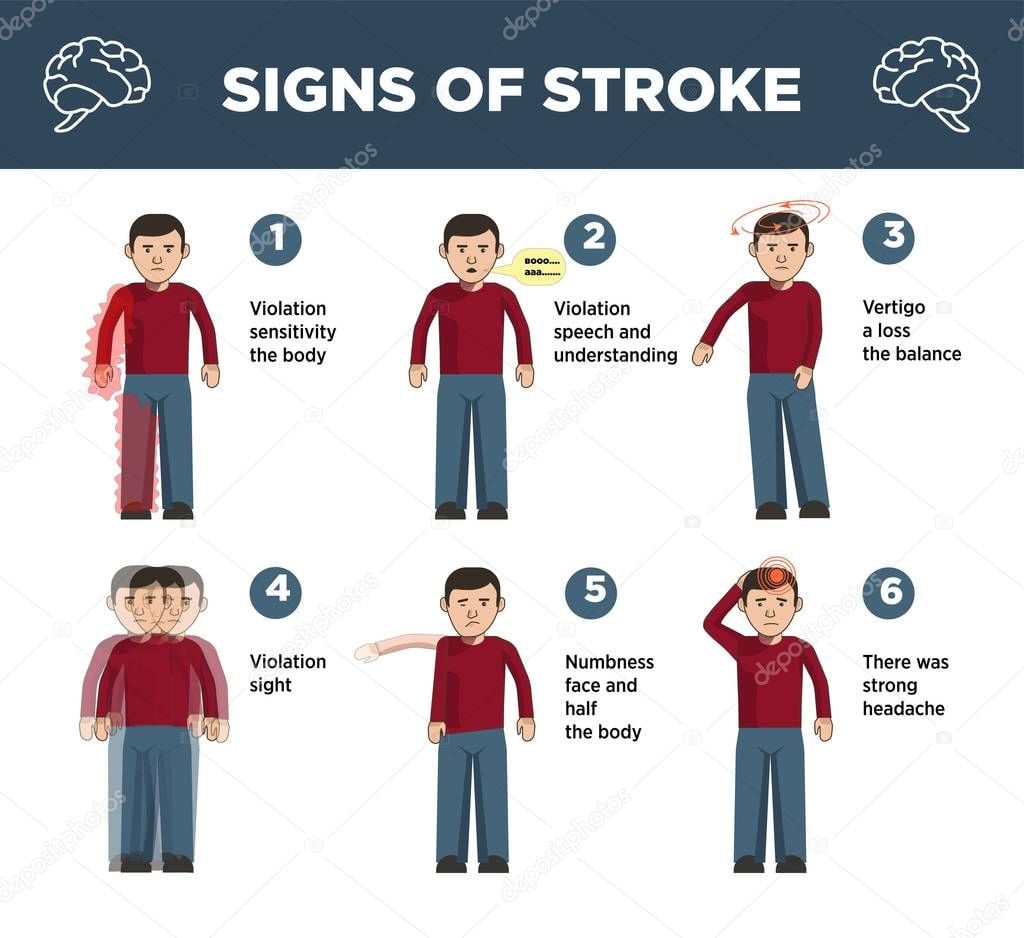 Heart stroke symptoms infographics template and vector icons of visual ...