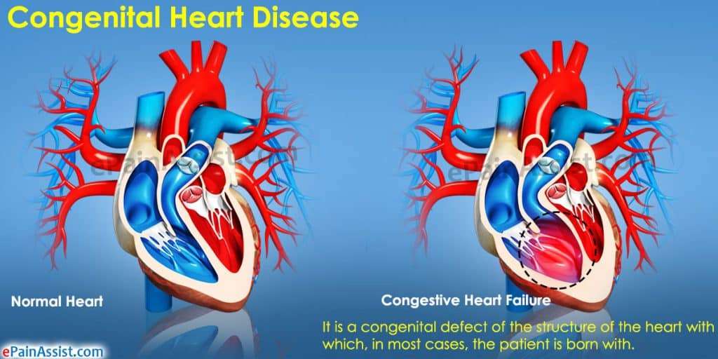 Hereditary Heart Disease Causes, Types, And Treatment