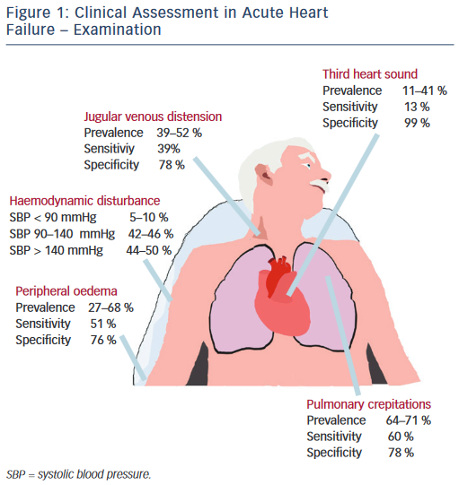 How To Improve Time To Diagnosis In Acute Heart Failure