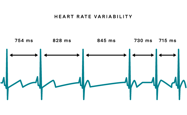 How To Measure Heart Rate Variability: ECG vs. PPG