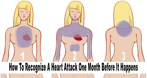 How To Recognize A Heart Attack One Month Before It ...