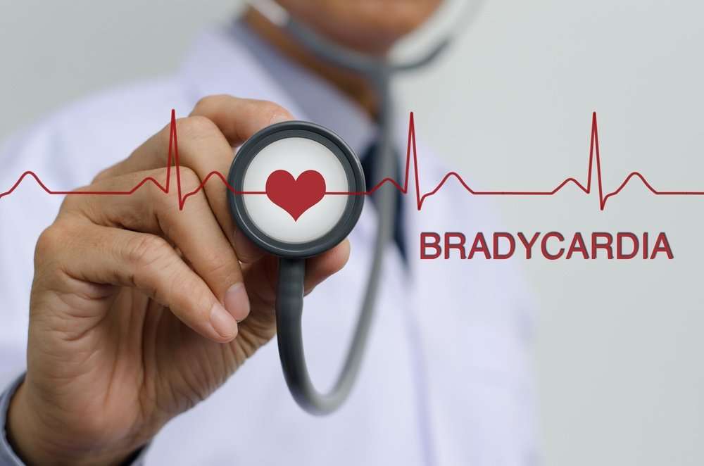 How to Recognize If You Have Bradycardia and How to Deal ...
