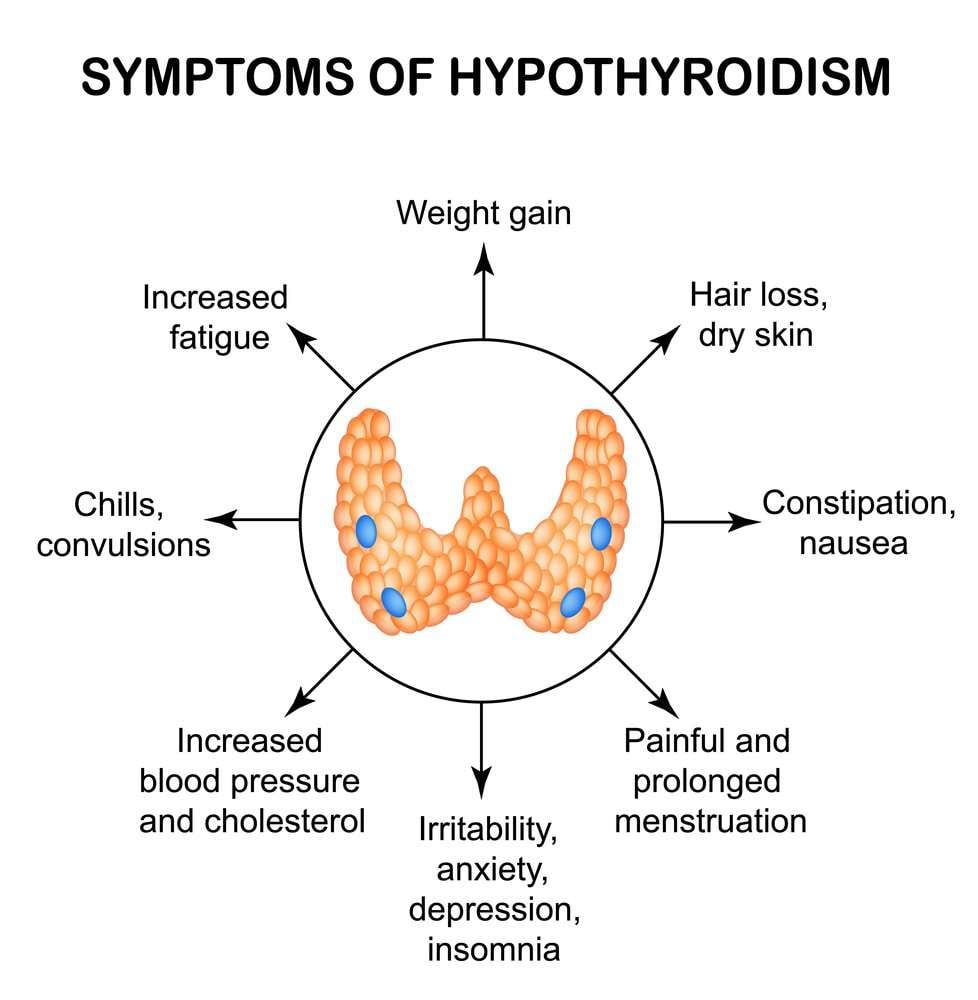 Hypothyroidism  Causes, Symptoms, Diagnosis, Treatment ...