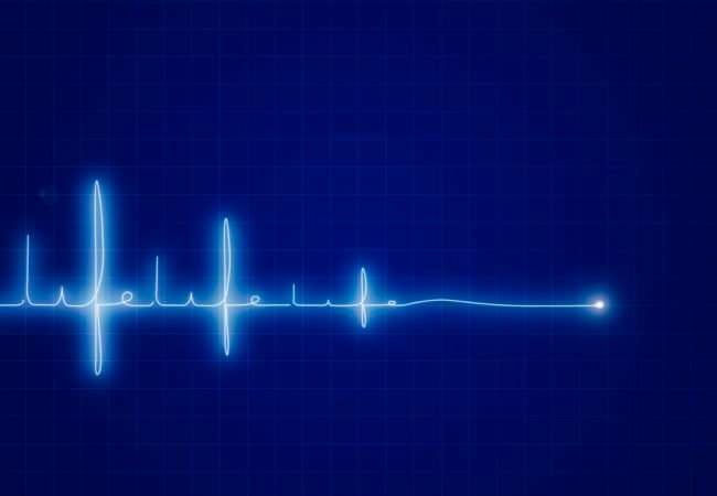 Is Slow Heart Rate Good or Bad for You?  Health ...