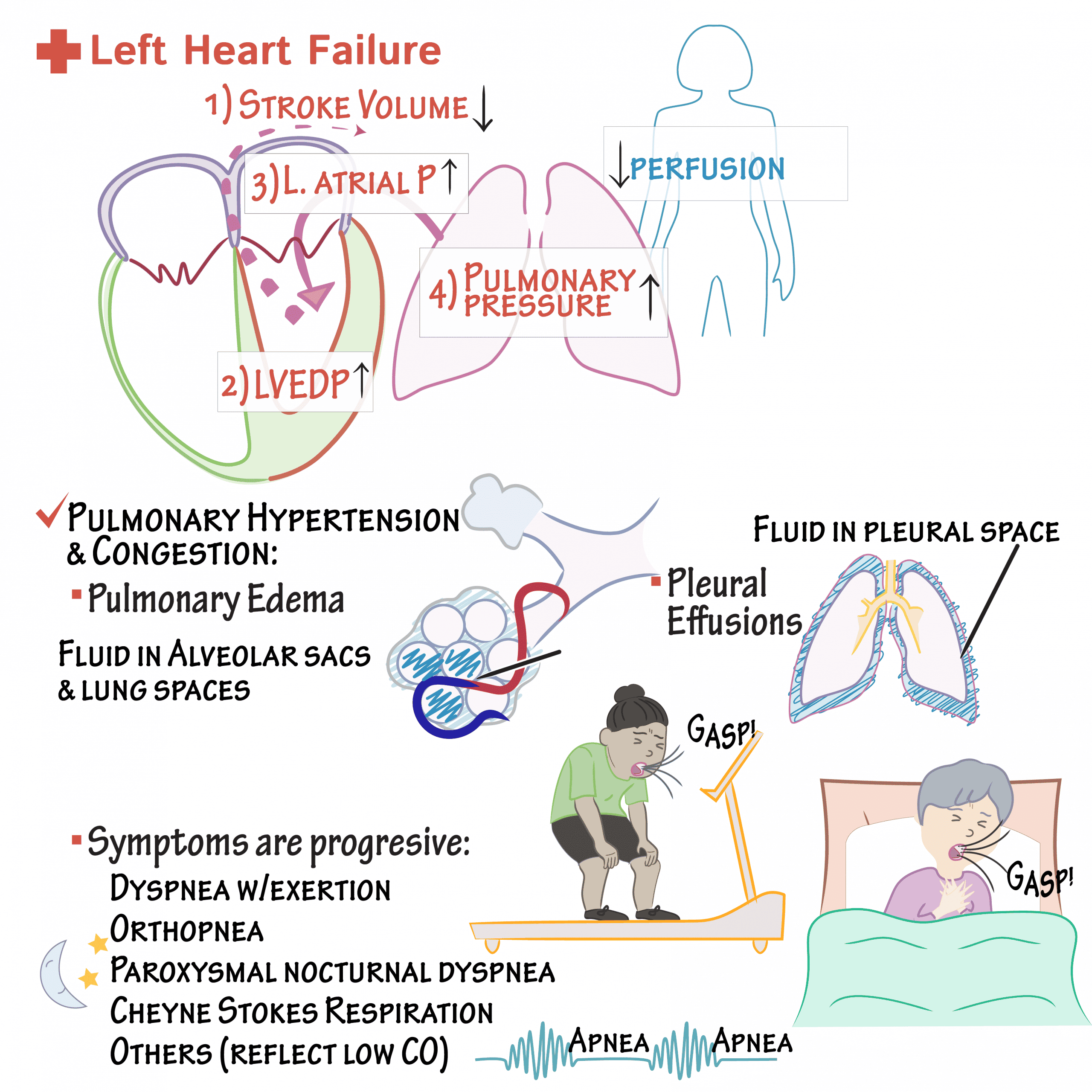 Left Heart Disease Symptoms