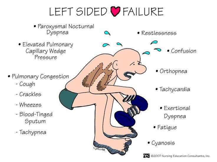 Left sided heart failure I always use this slide when I teach heart ...