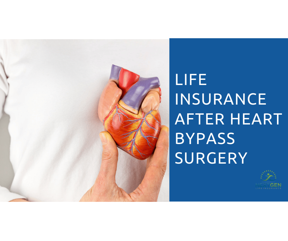 Life Insurance After Heart Bypass Surgery