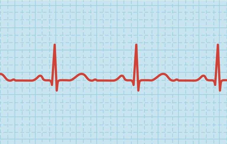 Lower Your Heart Rate to Prevent a Heart Attack