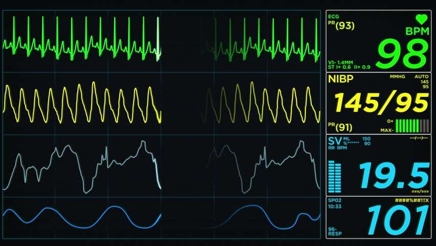 Medical Monitor Screen On Normal Heart Rate Loop Stock ...