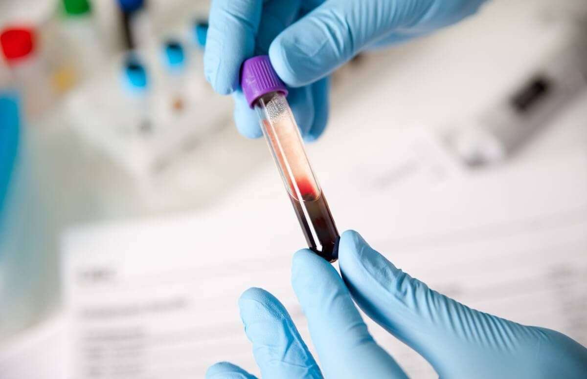 New Blood Test is Better, Fast at Diagnosing a Heart Attack