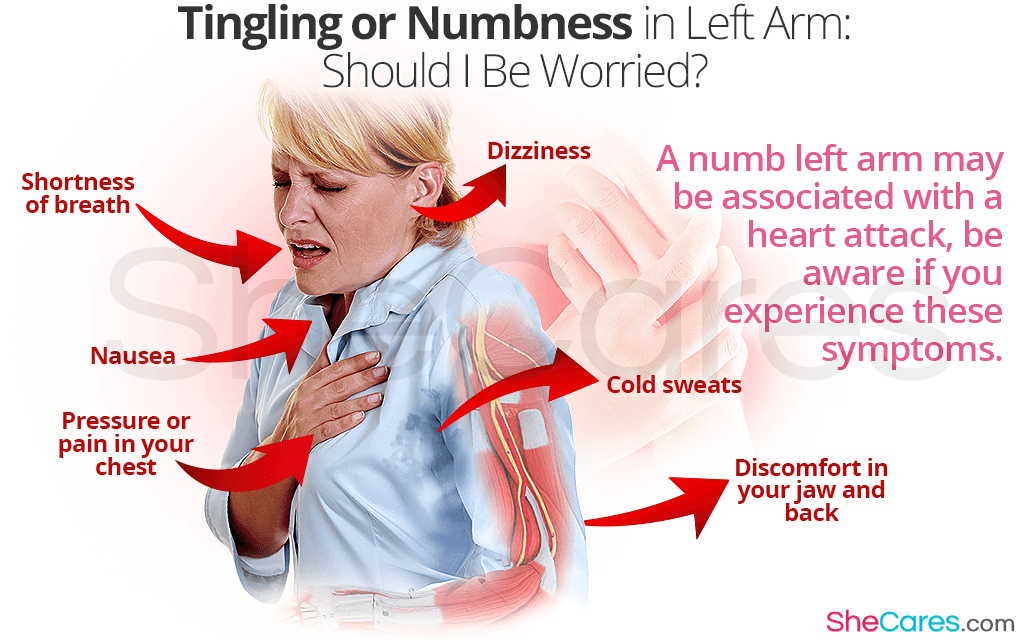 Numbness in Left Arm
