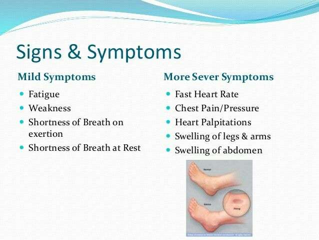 Pin on Congestive Heart Failure Signs and Symptoms