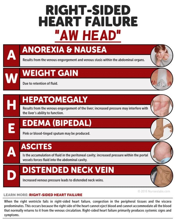 Right Sided Heart Failure Mnemonic: " AW HEAD"  ANOREXIA ...