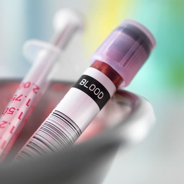 Scientists develop a blood test that can tell if you have suffered a ...