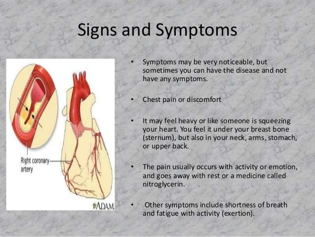 Signs and symptoms of coronary artery disease