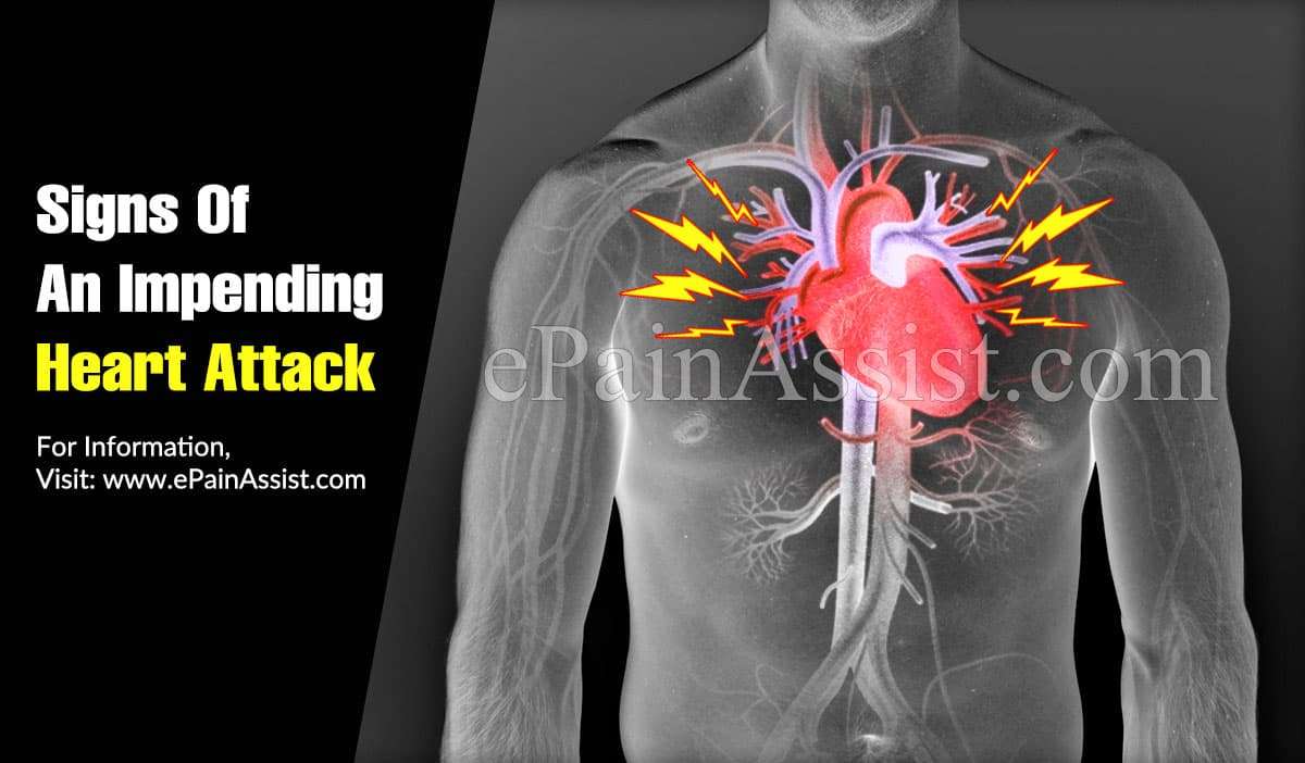 Signs Of An Impending Heart Attack