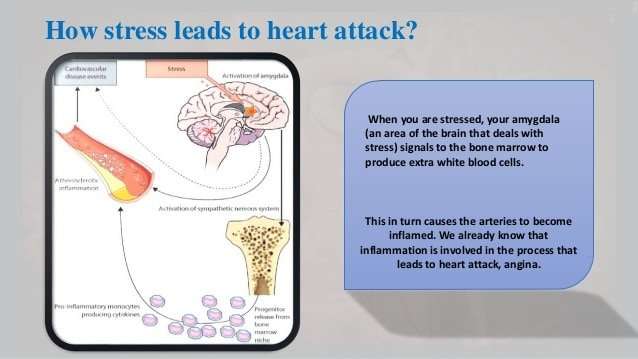 Stress with Heart Attack