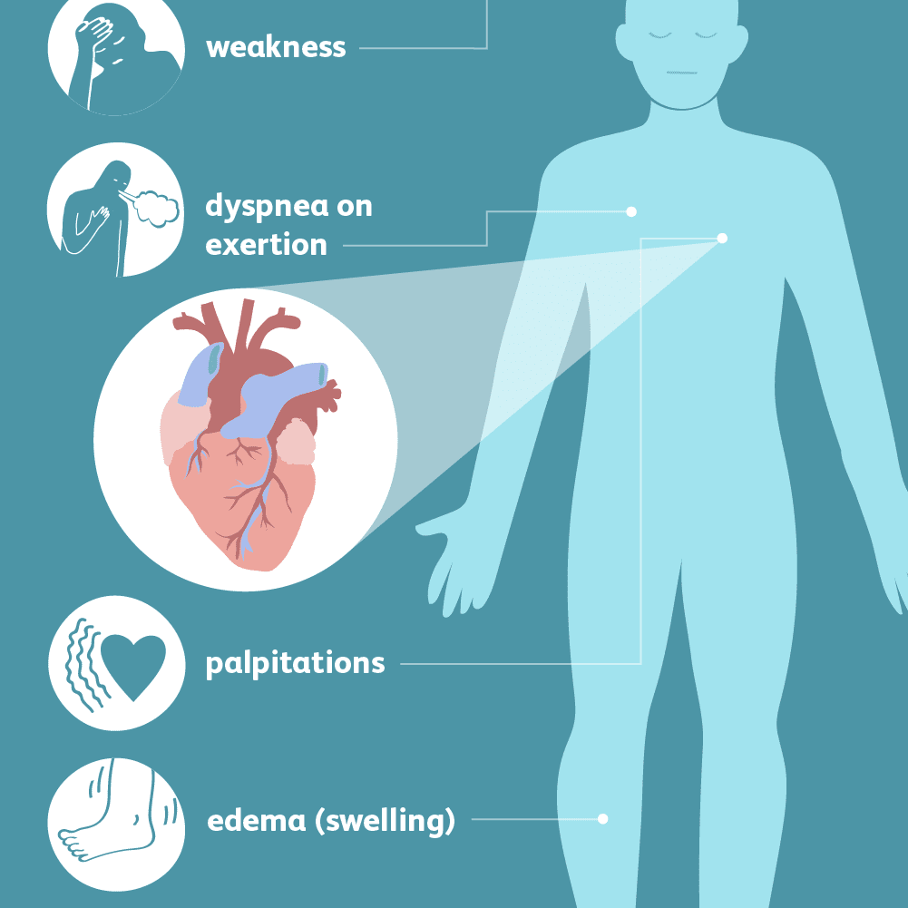 Symptoms and Complications of Heart Failure