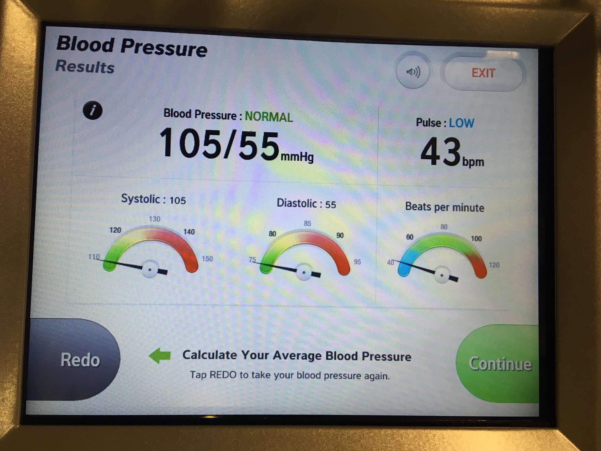Too low blood pressure and heart rate? (muscle, treadmill ...