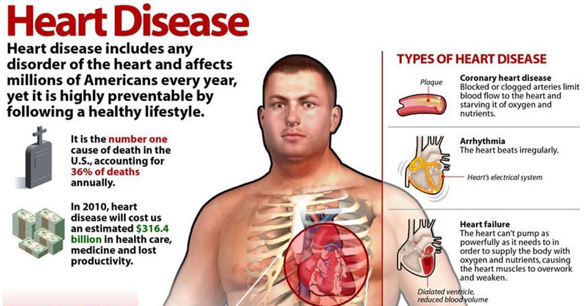 Types of Heart Disease [INFOGRAPHIC]