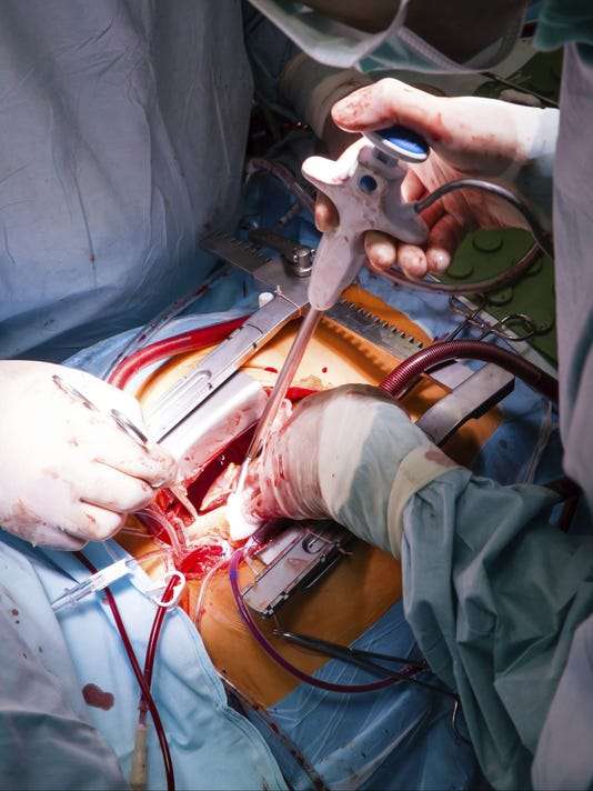 What hospitals perform heart transplants?