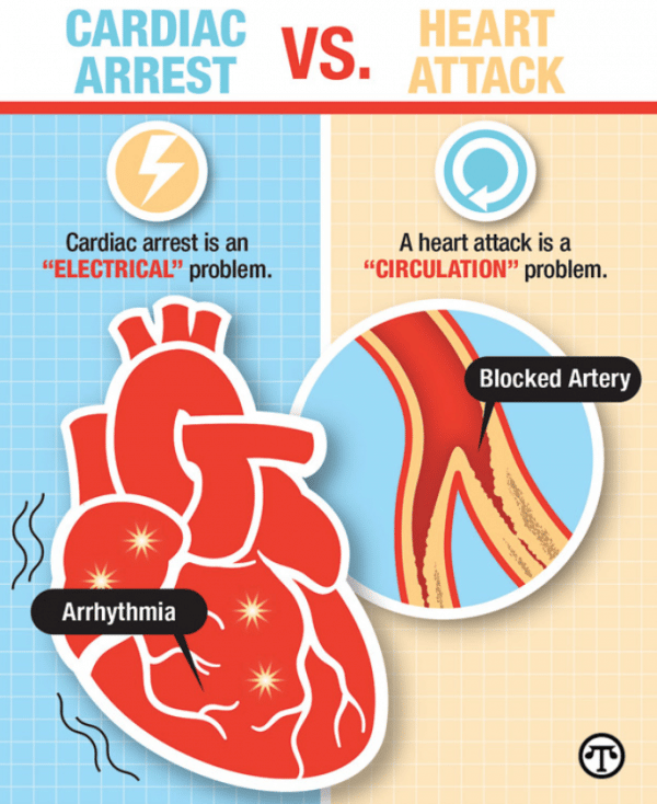 Why you should know the difference between Sudden Cardiac Arrest and a ...