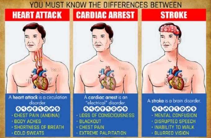 You Must Know the Differences between a Heart Attack ...