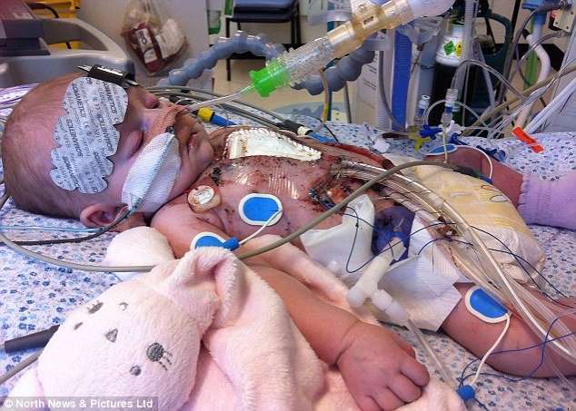 Youngest ever baby to undergo open heart surgery goes home ...